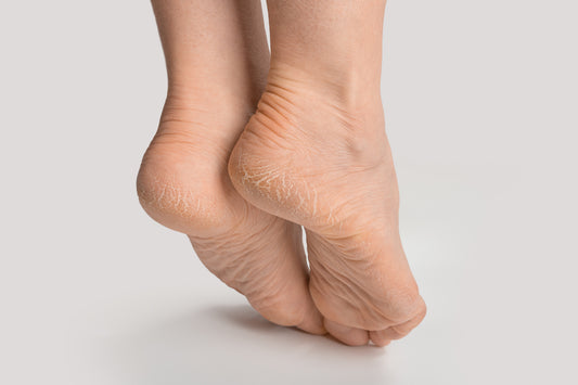 do-we-need-special-foot-moisturizer